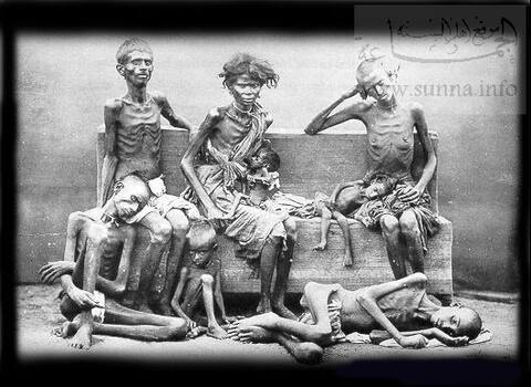 Skin and bones جلد و عظم